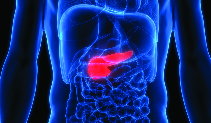 بائیں کندھے میں شدید درد اور لبلبے کے سرطان کا پہلا کیس سامنے آگیا