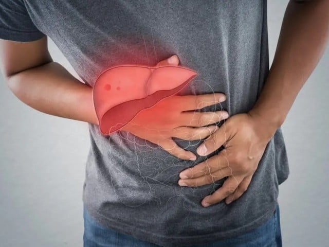 ہر 5 میں سے 1 فرد جگر کی چربی سے متعلقہ بیماری میں مبتلا ہے، تحقیق