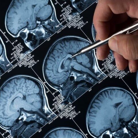 ذہنی عوارض میں اضافہ، ڈبلیو ایچ او کا عالمی برادری سے اہم مطالبہ
