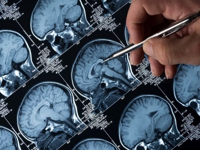 ذہنی عوارض میں اضافہ، ڈبلیو ایچ او کا عالمی برادری سے اہم مطالبہ