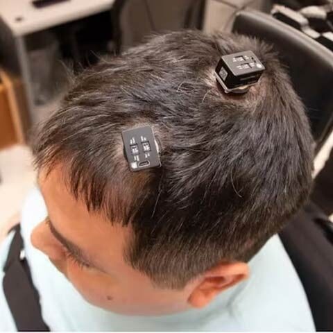 مفلوج شخص میں بیرونی مائیکروچپ سے لمس کا احساس جاگ اٹھا