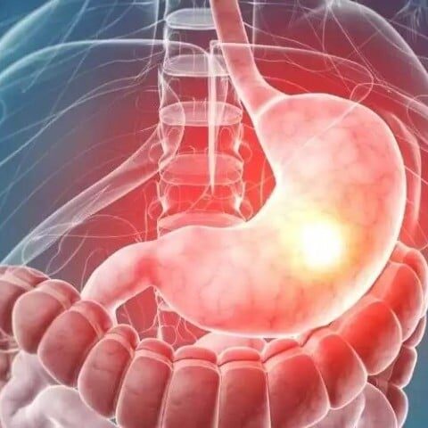 معدے کا کینسر، عوامل اور علاماتمعدے کا کینسر، عوامل اور علامات