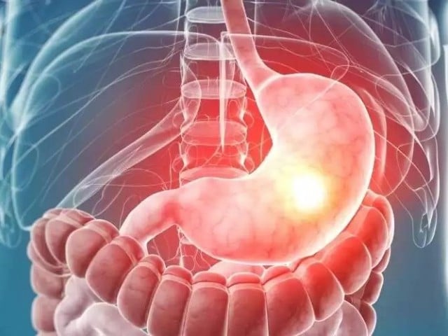 معدے کا کینسر، عوامل اور علامات