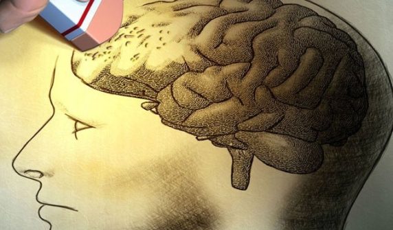 الزائمر کے مرض کی ساڑھے تین سال پہلے ہی تشخیص ممکن ہوگئی تحقیق