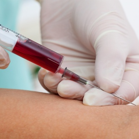 ٹیسٹ کیلئے زیادہ خون لینا، خون کی خطرناک حد تک کمی کا سبب ہوسکتا ہے