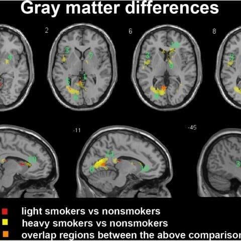 سگریٹ نوشی سے دماغ سکڑ جاتا ہے، سائنسی شواہد سامنے آگئے
