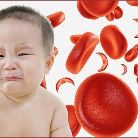 بچوں میں خون کی کمی بتانے والی ایپ تیار