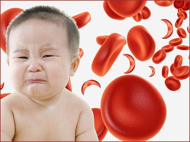 بچوں میں خون کی کمی بتانے والی ایپ تیار