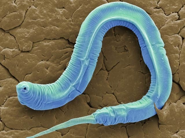 بلڈ پریشر کی عام دوا نے کیچووں میں بڑھاپے کو سست کردکھایا