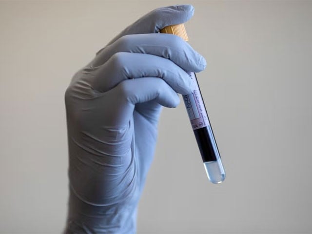 دل کے دورے کا خطرہ کم کرنے والا نیا خون کا ٹیسٹ